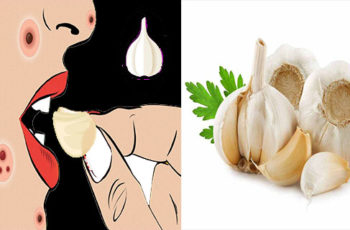 20 Surprising Benefits of Garlic That Keep the Doctor Away