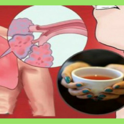 8 home remedies to treat bronchitis and stop painful coughing attacks