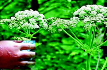 6 Poisonous Plants to Avoid at Home